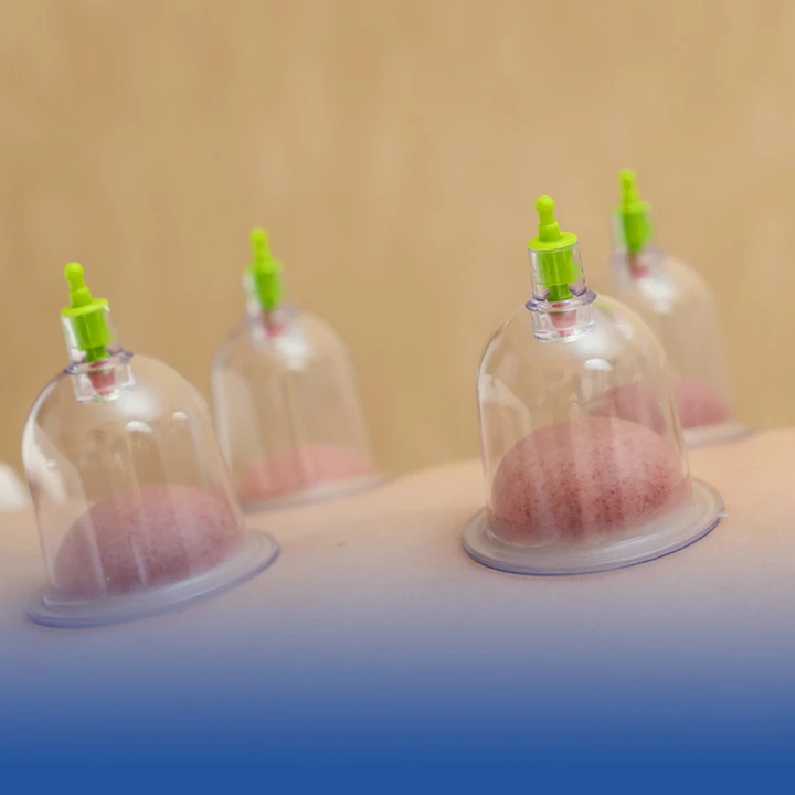Cupping Therapy: Unveiling the Ancient Art of Suction and Relief. MTP our Services